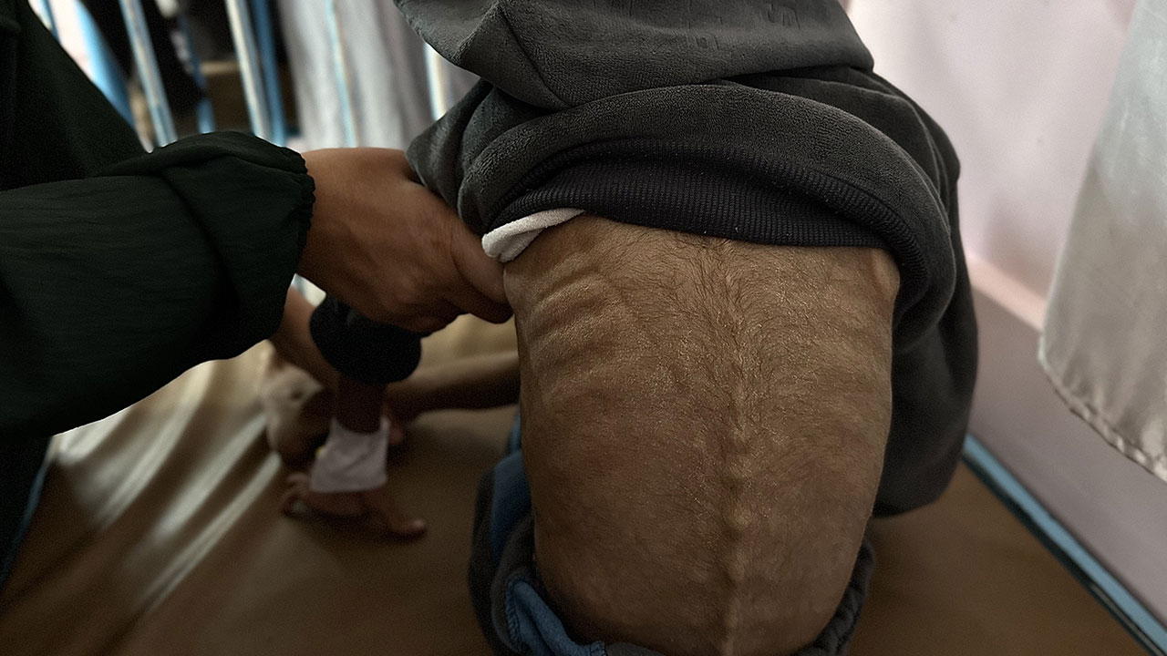 Foto - Gazzeli çocuklar açlıkla boğuşuyor