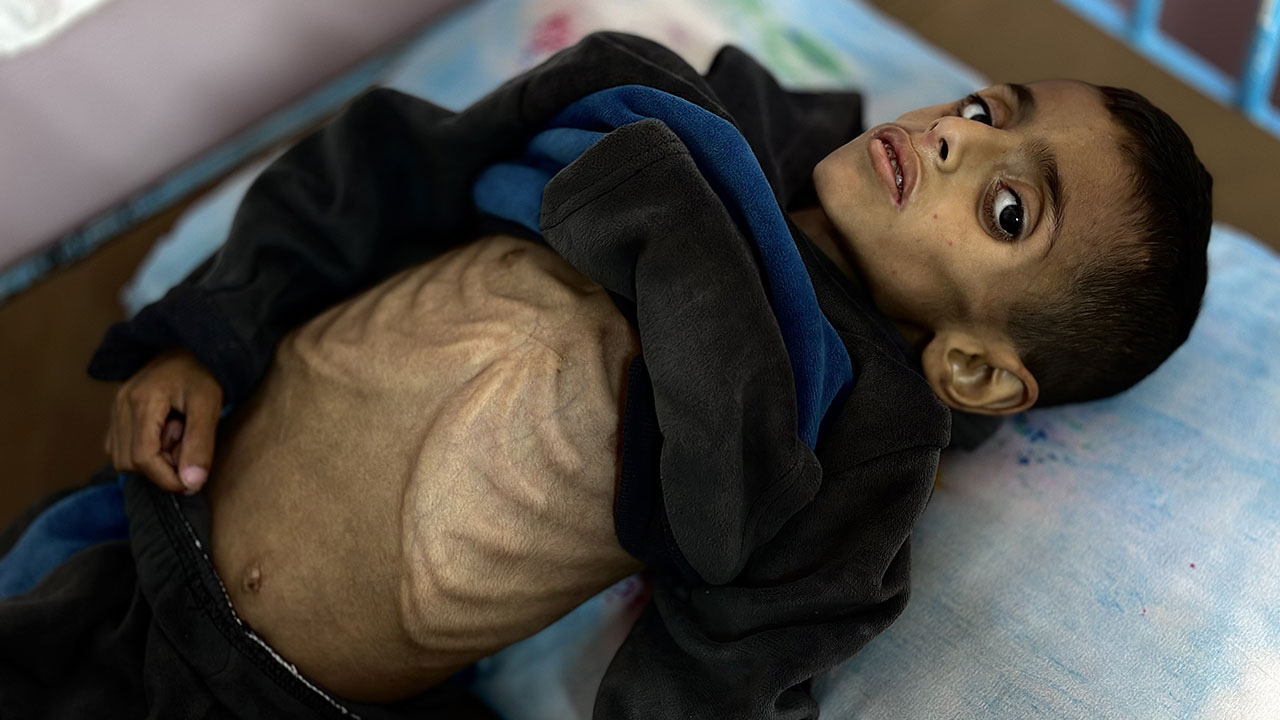 Foto - Gazzeli çocuklar açlıkla boğuşuyor