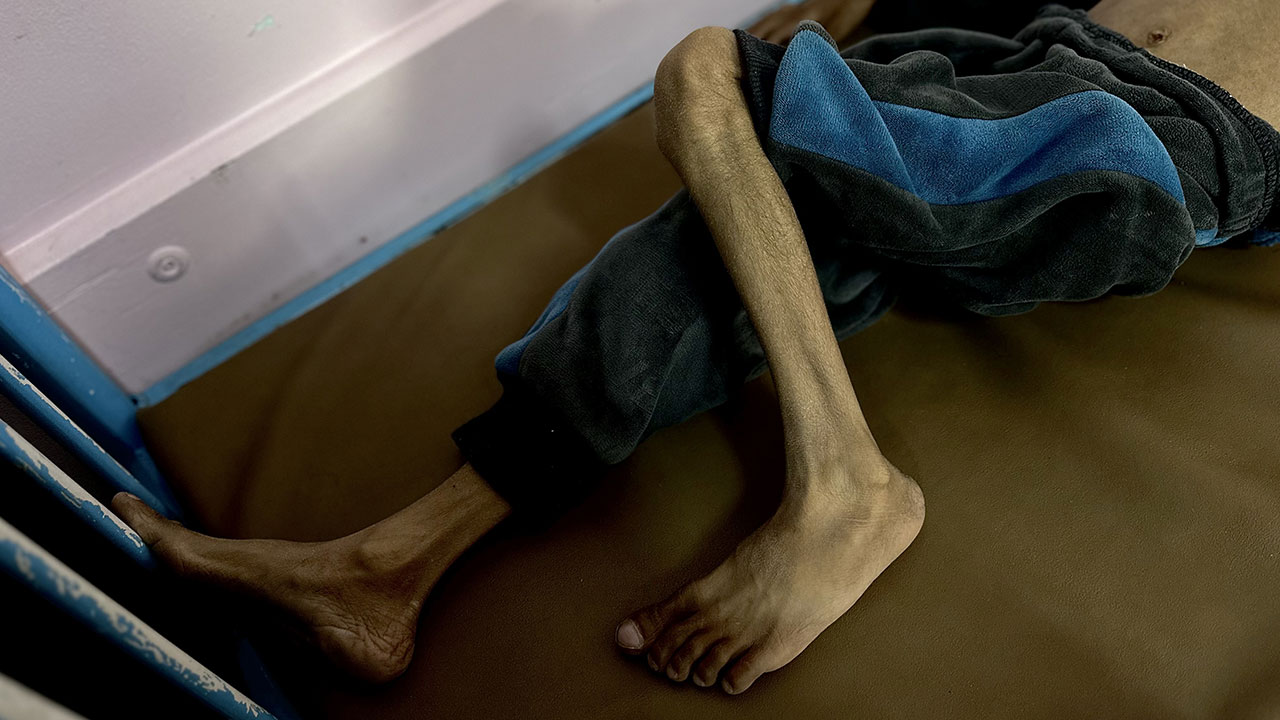 Foto - Gazzeli çocuklar açlıkla boğuşuyor