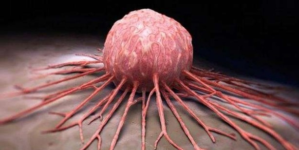 Foto - Gece uyumadan önce zerdeçallı süt içerseniz ne olur? Sonucu görün, bakın neler oluyor: Kimse bu etkilerini bilmiyor! 