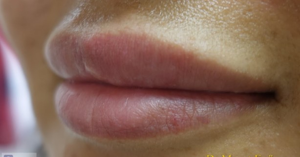 Foto - Gece uyurken ağzınızı bantlayıp yatarsanız bakın ne oluyor! Herkes yapmaya başladı