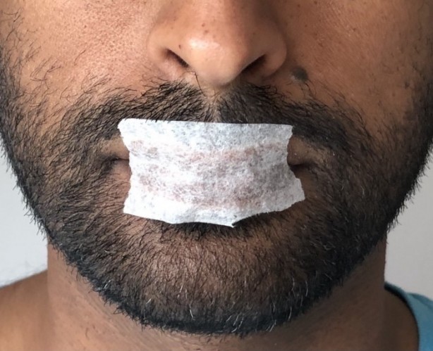 Foto - Gece uyurken ağzınızı bantlayıp yatarsanız bakın ne oluyor! Herkes yapmaya başladı