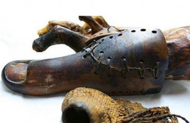 Foto - Geçmişteki bu tedavi yöntemlerine inanamayacaksınız