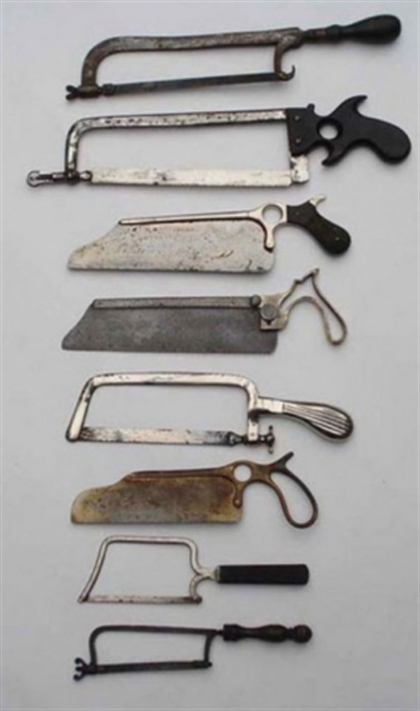 Foto - Geçmişteki bu tedavi yöntemlerine inanamayacaksınız