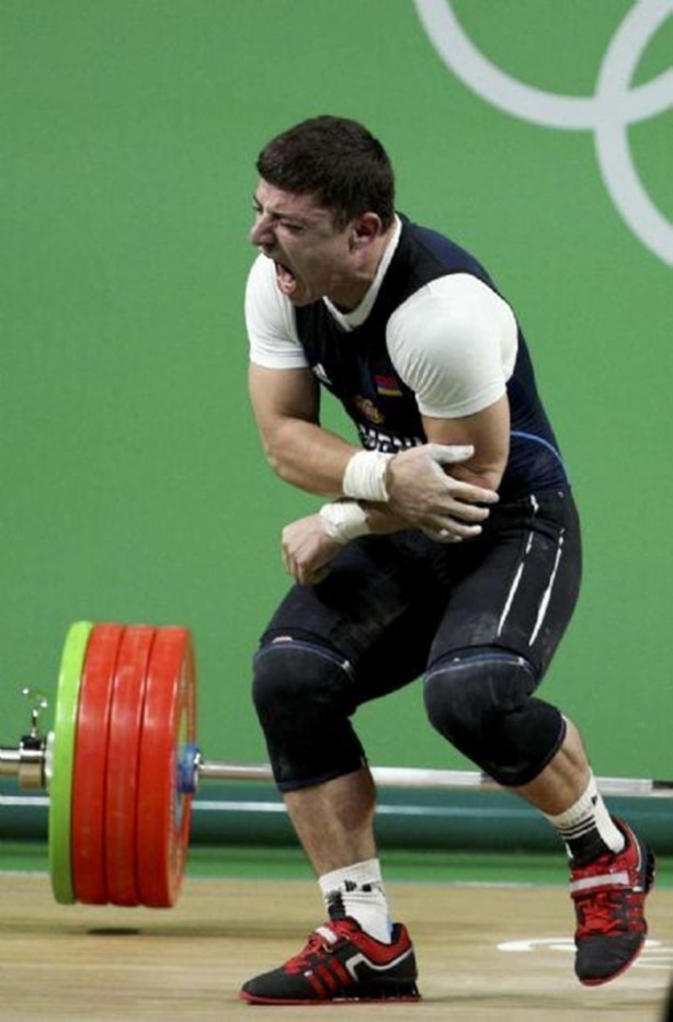 Foto - Genç haltercinin kolu ters döndü