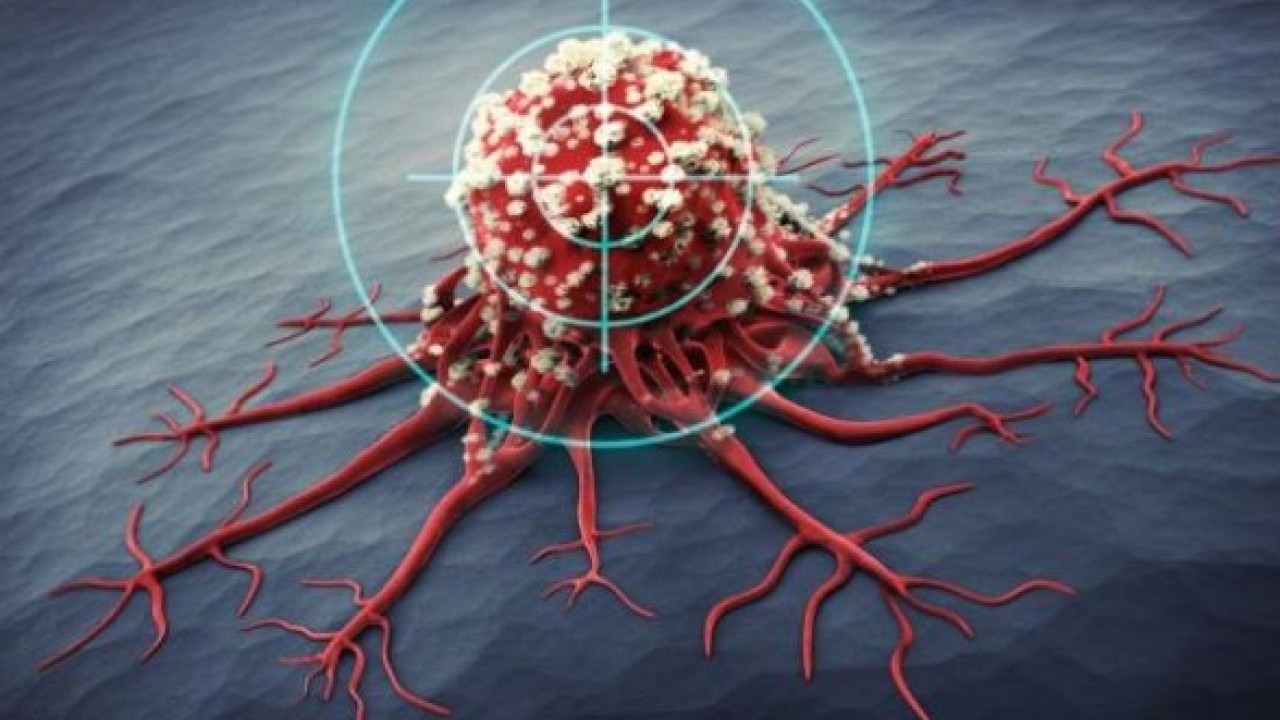 Foto - Gençlerde vakalar artıyor! Bağırsak kanserinin 5 nedeni açıklandı