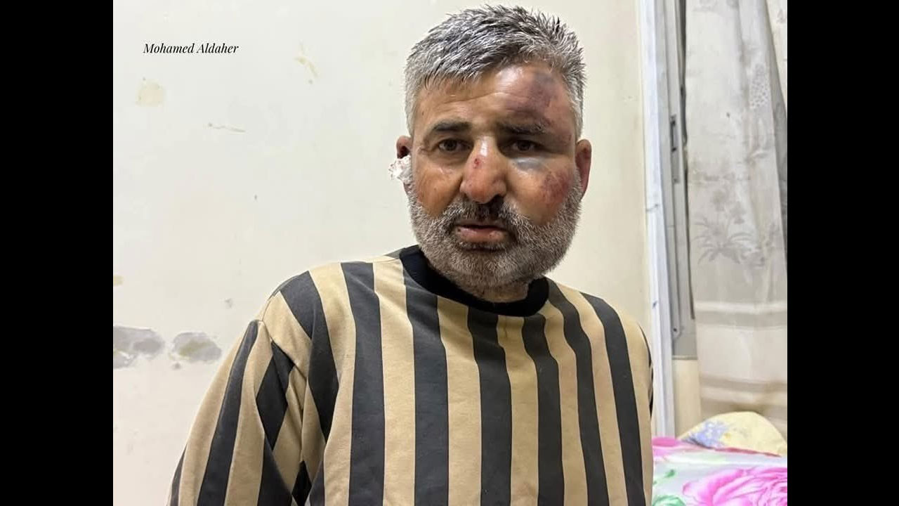 Foto - Geride binlerce cinayet bıraktı! O katil sonunda enselendi