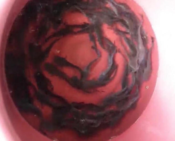 Foto - Gizli kamerayla çekildi! 'Bir sonraki salgın kaçınılmaz'