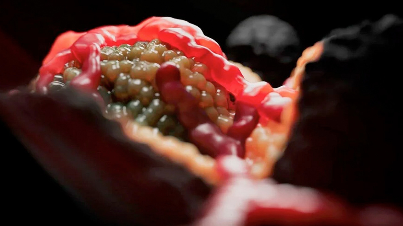 Foto - Gizli pankreas kanseri riskiyle milyonlarca insan karşı karşıya: Milyonlarca kişi bu aynı hatayı yapıyor