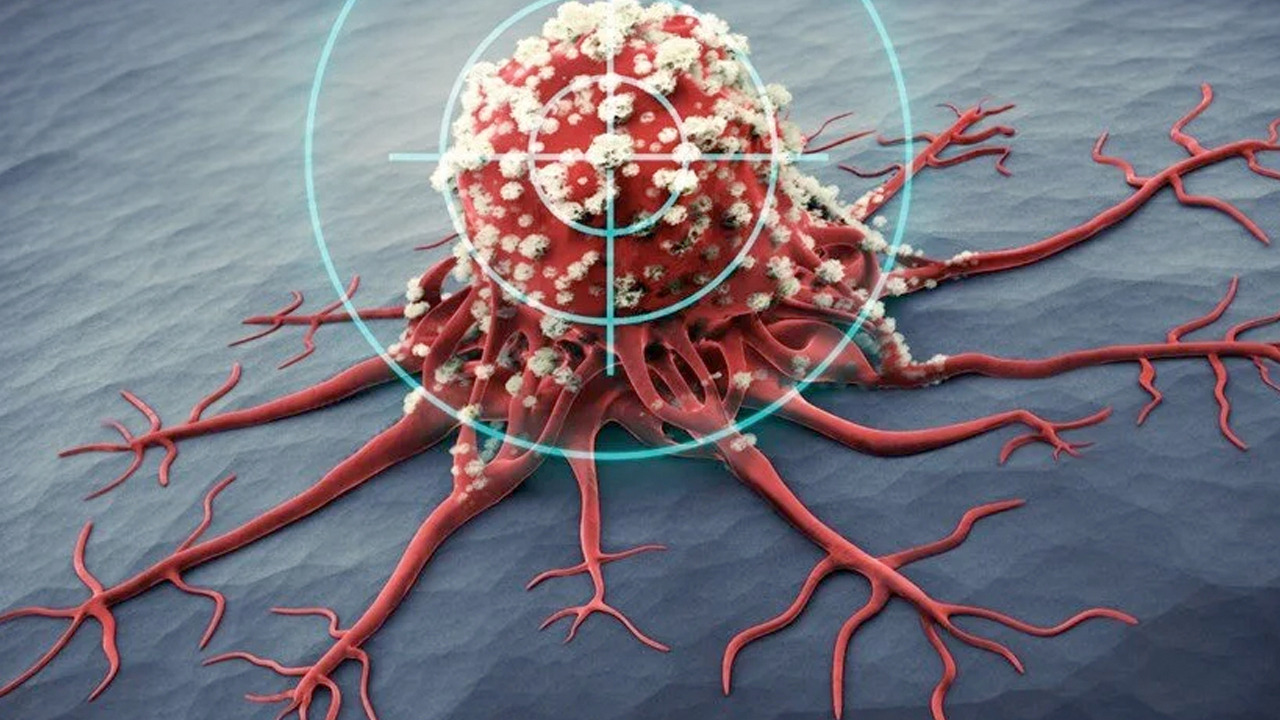 Foto - Gizli pankreas kanseri riskiyle milyonlarca insan karşı karşıya: Milyonlarca kişi bu aynı hatayı yapıyor