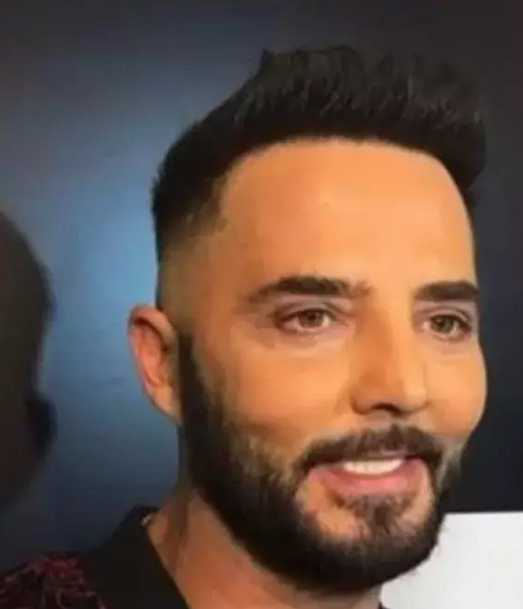 Foto - Gökhan Özen ile iddiaya girmiş! İşte bu beklenmiyordu: Şok eden estetik çıkışı: Peş peşe açıklamalar…