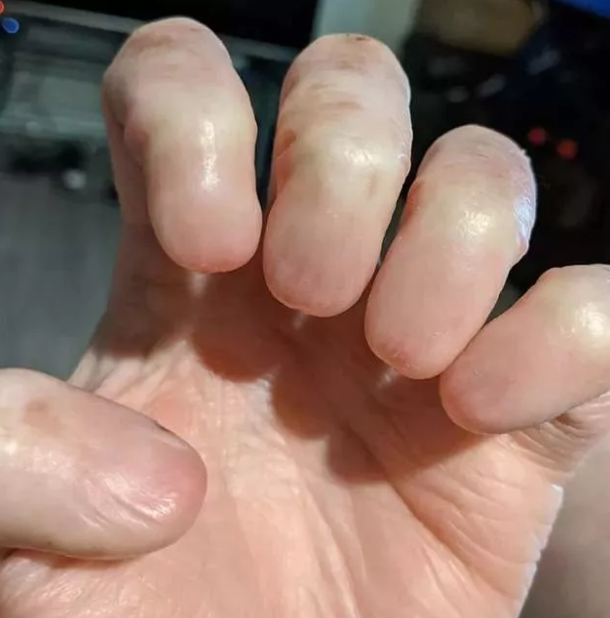 Foto - Gördüğünüzde çok şaşıracaksınız! En ilginç fiziksel özelliğe sahip 18 insan