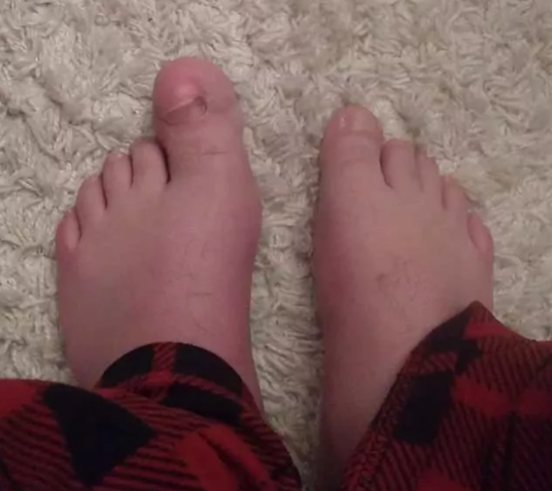 Foto - Gördüğünüzde çok şaşıracaksınız! En ilginç fiziksel özelliğe sahip 18 insan