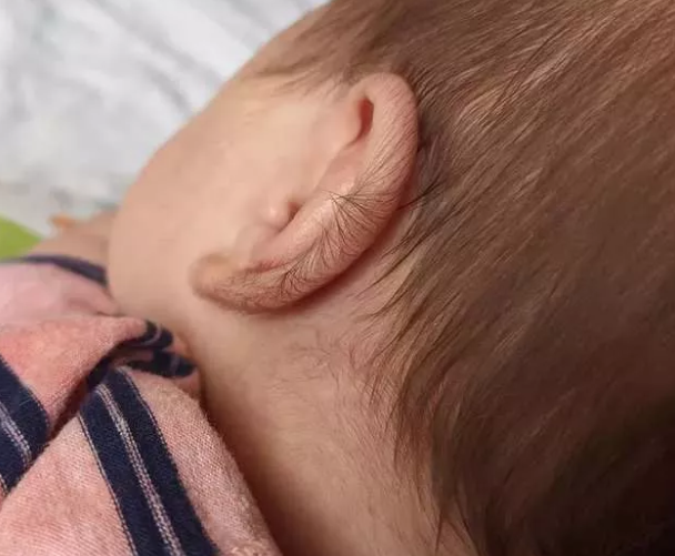 Foto - Gördüğünüzde çok şaşıracaksınız! En ilginç fiziksel özelliğe sahip 18 insan