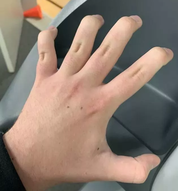 Foto - Gördüğünüzde çok şaşıracaksınız! En ilginç fiziksel özelliğe sahip 18 insan