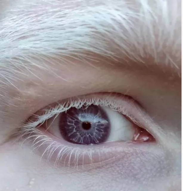 Foto - Gördüğünüzde çok şaşıracaksınız! En ilginç fiziksel özelliğe sahip 18 insan