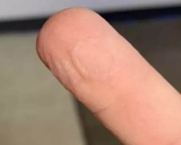 Foto - Gördüğünüzde çok şaşıracaksınız! En ilginç fiziksel özelliğe sahip 18 insan