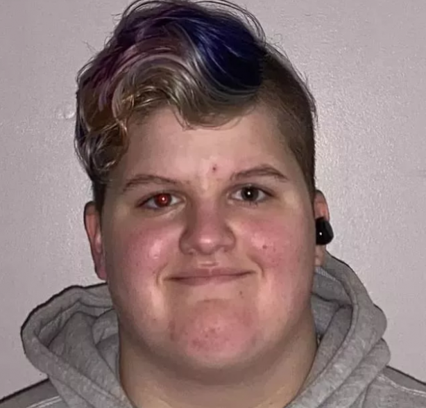 Foto - Gördüğünüzde çok şaşıracaksınız! En ilginç fiziksel özelliğe sahip 18 insan