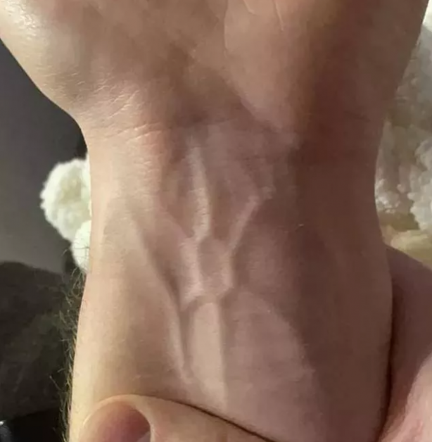 Foto - Gördüğünüzde çok şaşıracaksınız! En ilginç fiziksel özelliğe sahip 18 insan