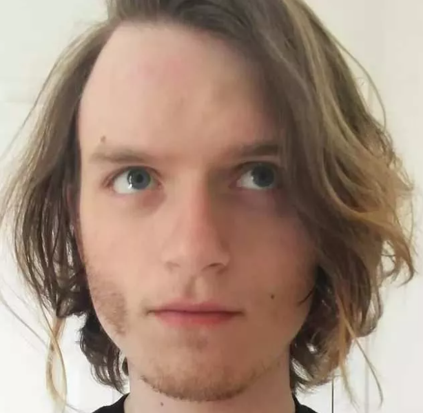 Foto - Gördüğünüzde çok şaşıracaksınız! En ilginç fiziksel özelliğe sahip 18 insan