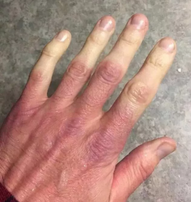 Foto - Gördüğünüzde çok şaşıracaksınız! En ilginç fiziksel özelliğe sahip 18 insan