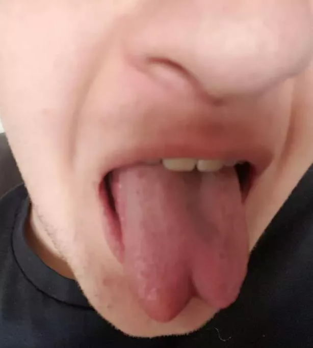 Foto - Gördüğünüzde çok şaşıracaksınız! En ilginç fiziksel özelliğe sahip 18 insan