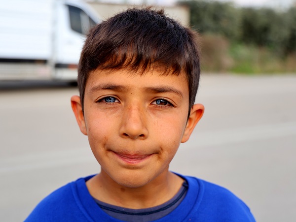 Foto - Görenler şaşırıp kalıyor! Bu çocuk dünyaya çift renk bakıyor