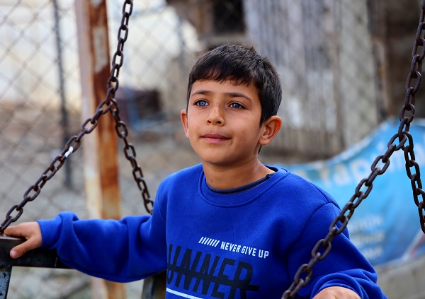 Foto - Görenler şaşırıp kalıyor! Bu çocuk dünyaya çift renk bakıyor