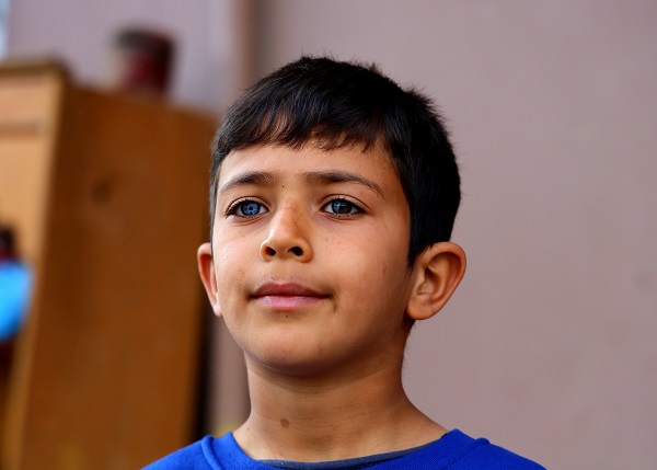 Foto - Görenler şaşırıp kalıyor! Bu çocuk dünyaya çift renk bakıyor