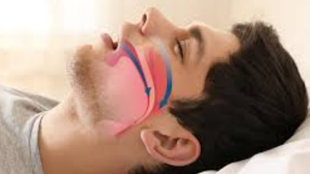 Foto - Göründüğü kadar masum değil! Horlamak ciddi sağlık sorunlarına yol açıyor