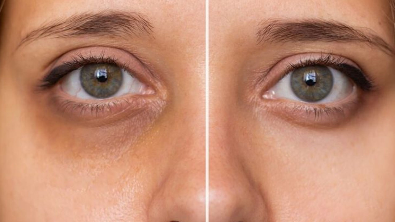 Foto - Kazayaklarını silip süpürüyor!