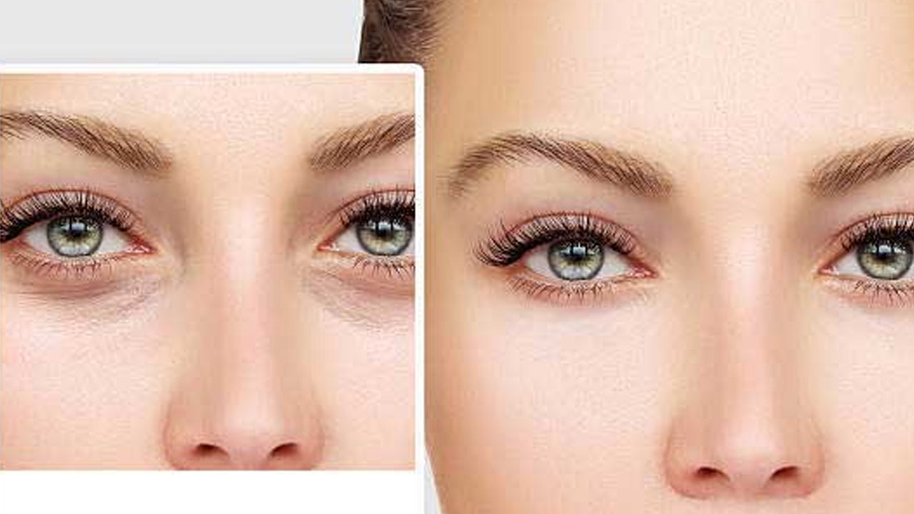 Foto - Kazayaklarını silip süpürüyor!