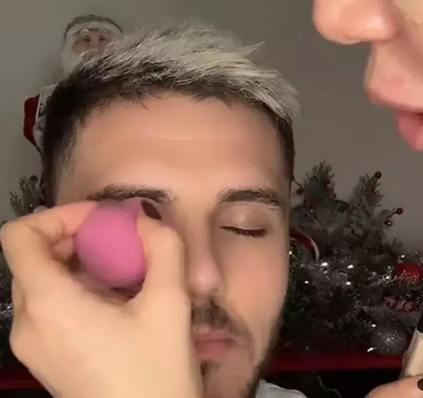 Foto - Göz morluğu gündem oldu! Flaş açıklama geldi: İşi şova döktüler! Futbolu unutunca Nara devreye girdi...