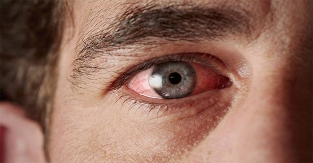 Foto - Göz sağlığına iyi gelen besinler