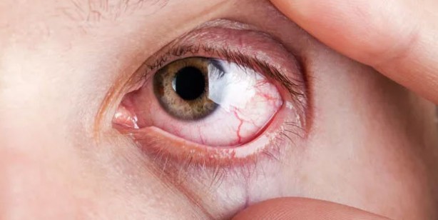 Foto - Göz sağlığına iyi gelen besinler