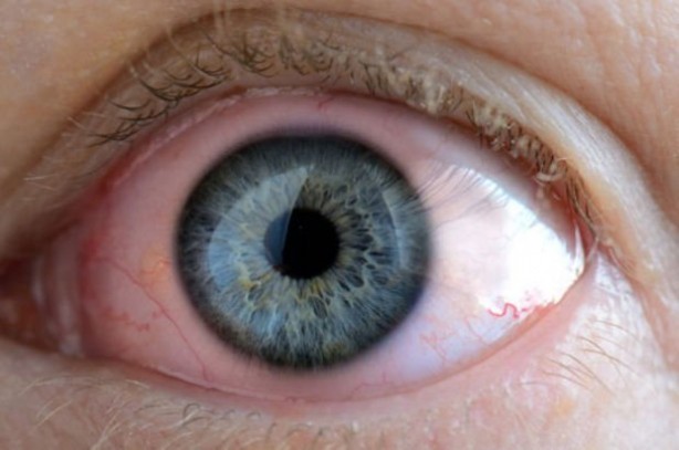 Foto - Göz sağlığına iyi gelen besinler