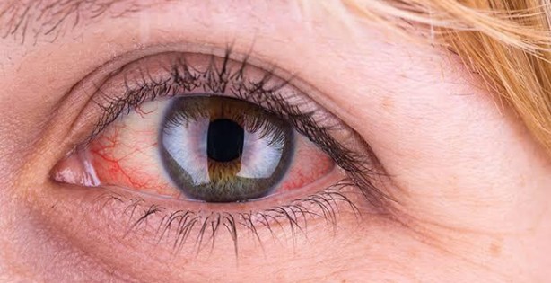 Foto - Göz sağlığını koruyan 10 besin