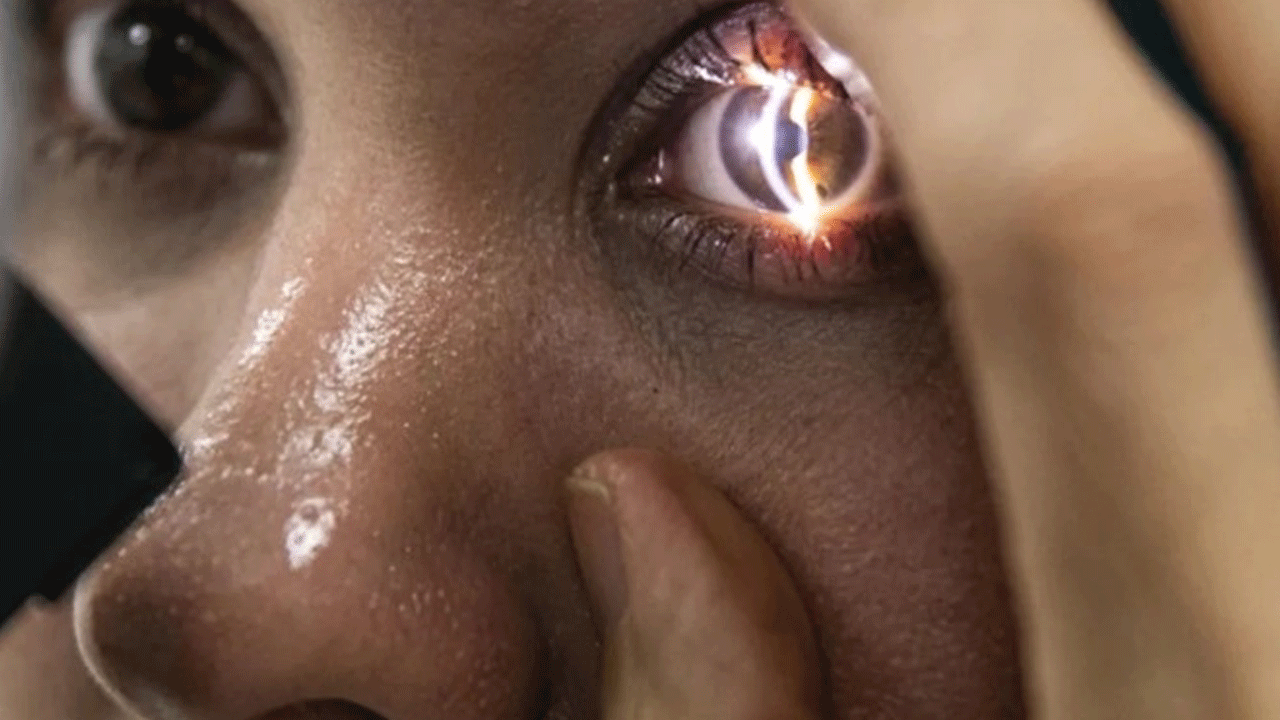 Foto - Lazer korkusu olanlar dikkat: Göz tedavisinde devrim gibi buluş!