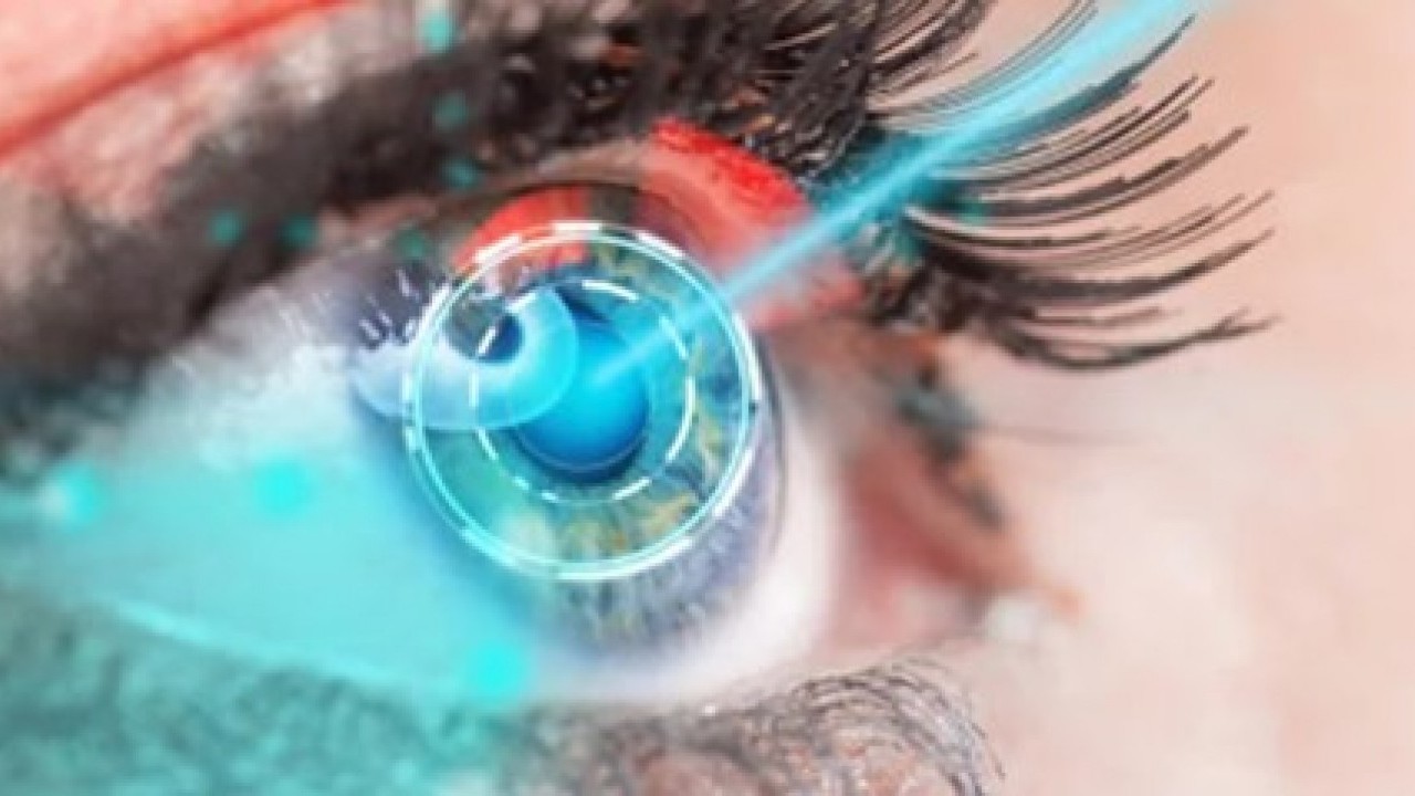 Lazer korkusu olanlar dikkat: Göz tedavisinde devrim gibi buluş!