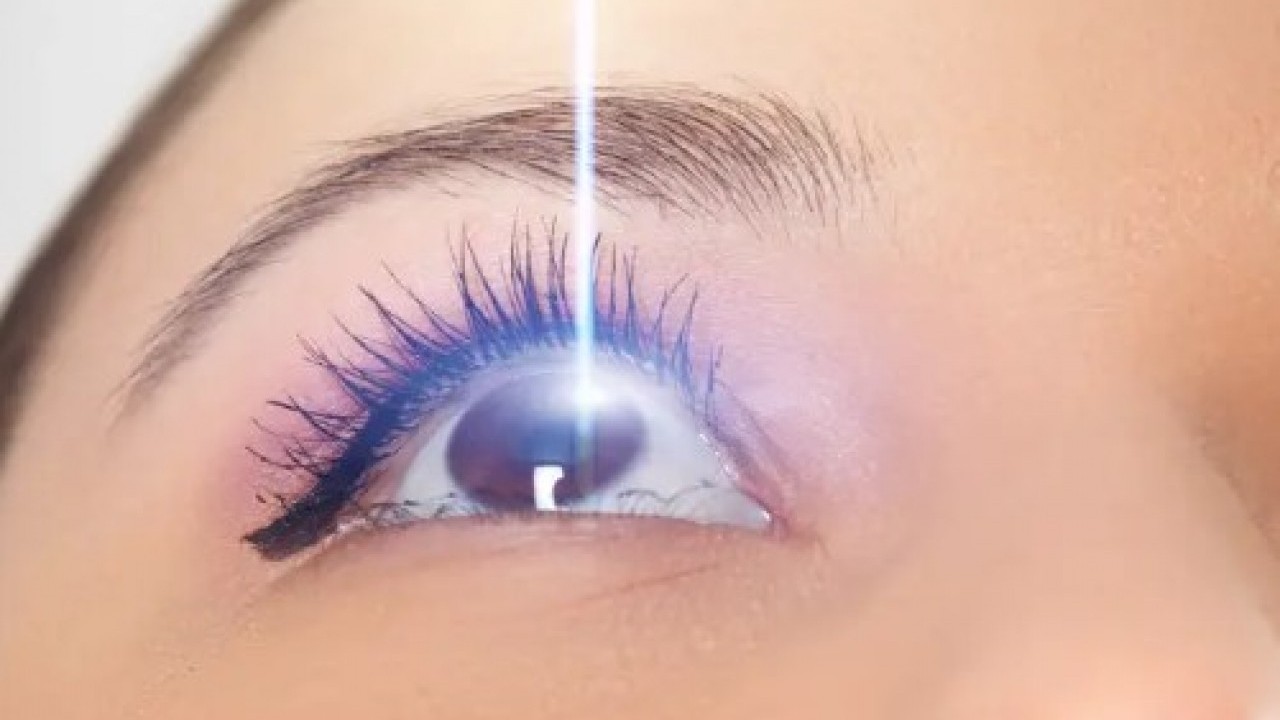 Foto - Lazer korkusu olanlar dikkat: Göz tedavisinde devrim gibi buluş!