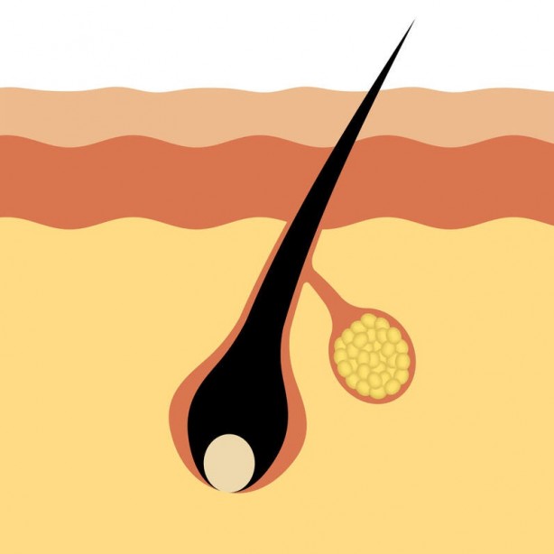 Foto - Gözenekler neden belirginleşir?