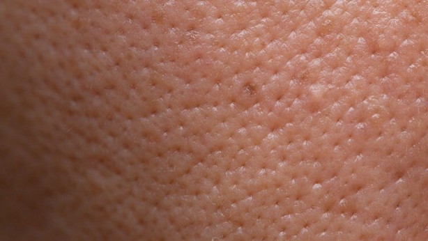 Gözenekler neden belirginleşir?