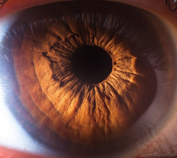 Foto - Gözlere bir de yakından bakın