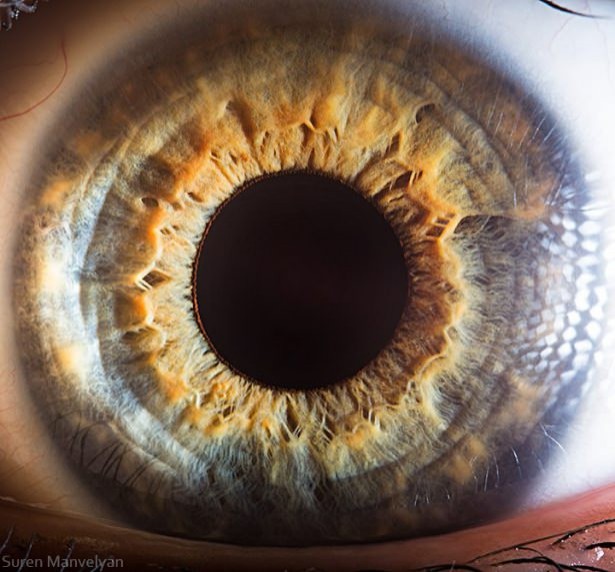Foto - Gözlere bir de yakından bakın