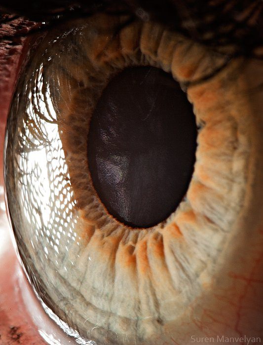 Foto - Gözlere bir de yakından bakın