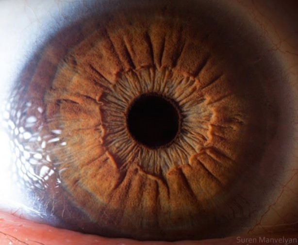 Foto - Gözlere bir de yakından bakın
