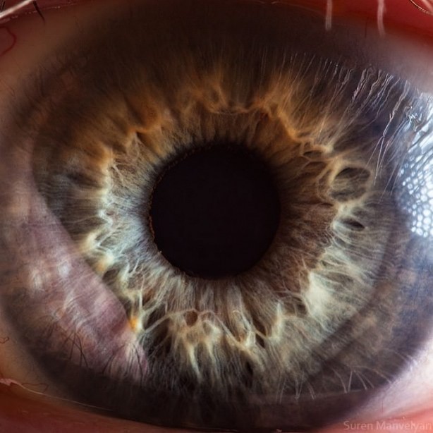 Foto - Gözlere bir de yakından bakın