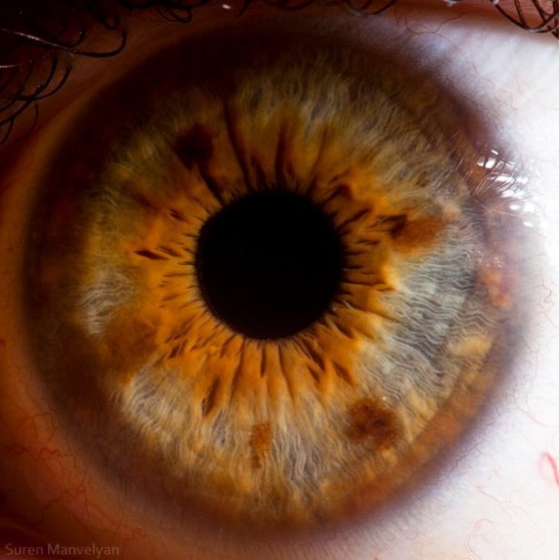 Foto - Gözlere bir de yakından bakın