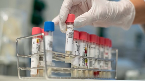 Foto - Gözlere dikkat! Koronavirüs işareti olabilir