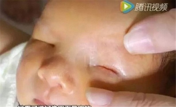 Foto - Gözleri olmadan doğdu!